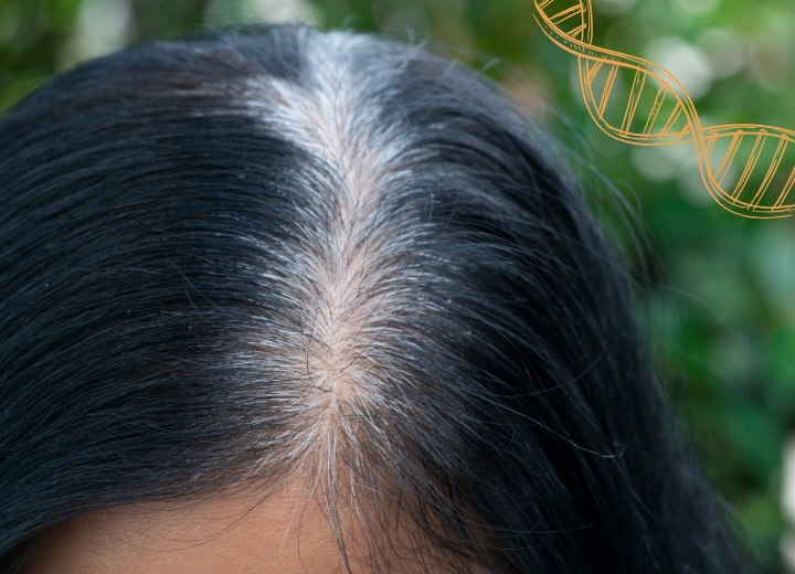 Ergrauendes Haar, genetisch bedingt