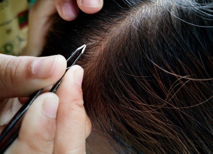 Weiße Haare Auszupfen